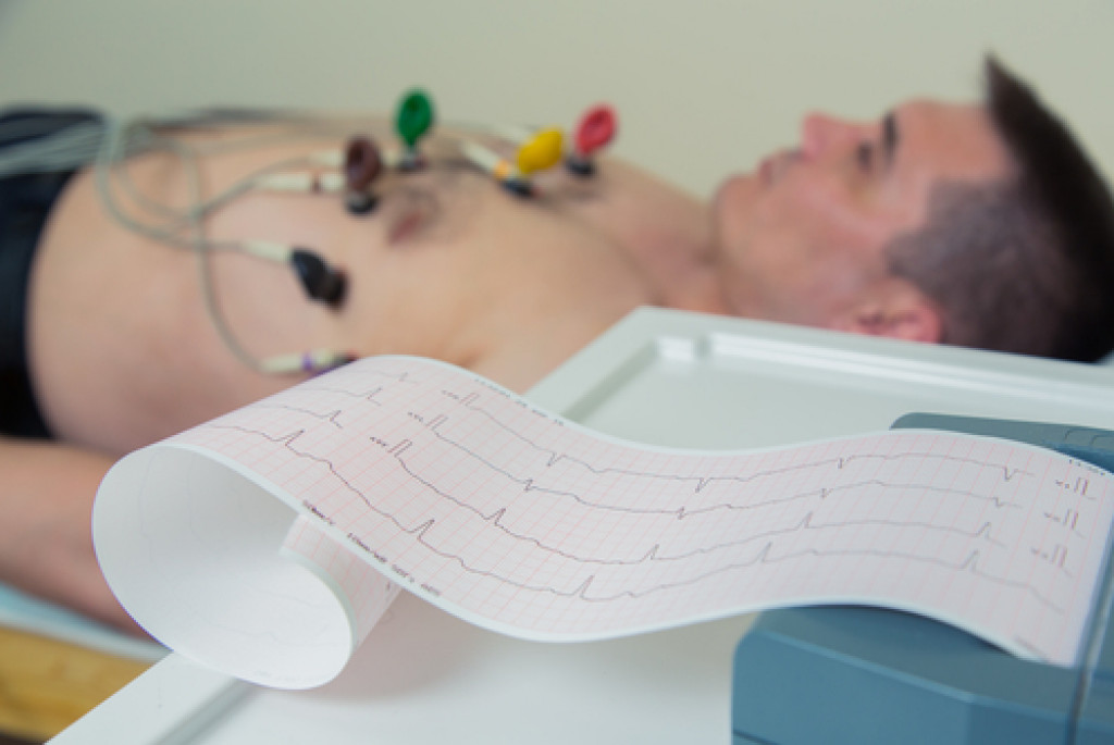 ecg test